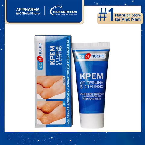 Kem Kpem Giúp Giảm Nứt Nẻ, Chăm Sóc Da Gót Chân Mềm Mại