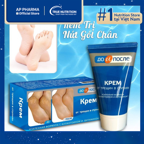 Kem Kpem Giúp Giảm Nứt Nẻ, Chăm Sóc Da Gót Chân Mềm Mại