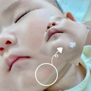 Kem Dịu Da Atono2 Phục Hồi Chuyên Biệt SOS 20Gr