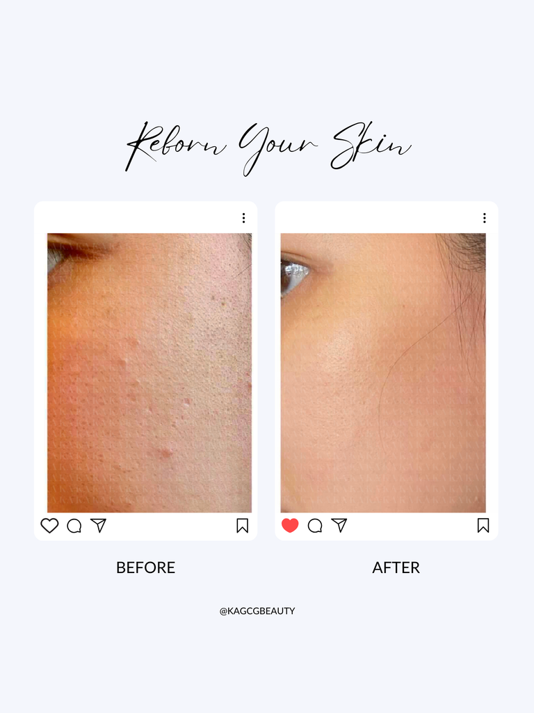 Tinh Chất Nuôi Dưỡng Làn Da Căng Bóng GLOWING SERUM KA GCG [Clearance – HSD 08/2026]