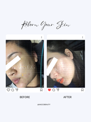 Tinh Chất Dưỡng Sáng Da BRIGHTENING SERUM KA GCG [Clearance – HSD 08/2026]
