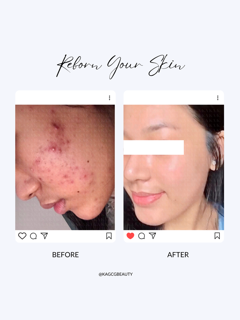 Kem Dưỡng Tái Tạo Da Ban Đêm NIGHT CREAM KA GCG