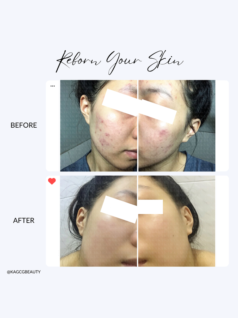 Mặt Nạ Thảo Mộc MAGIC MASK KA GCG