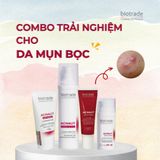  Combo trải nghiệm giảm mụn bọc 