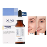  Serum Obagi Vitamin C + Arbutin Brightening 30ml 