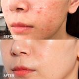  Neostrata Oily Skin Solution 8% AHA 100ml 