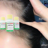  Dung Dịch Kích Thích Mọc Tóc Sato 30ml 