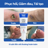  Gel băng vết thương hở LAVIOR Diabetic Hydrogel Wound Dressing (30ml) 