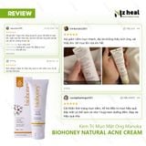  Kem dưỡng da dành cho da mụn Biohoney Natural Acne Cream 50g 