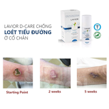  Gel chống loét tiểu đường LAVIOR Diabetic Wound Gel 15ml/ 50ml 