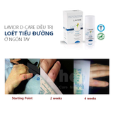  Gel chống loét tiểu đường LAVIOR Diabetic Wound Gel 15ml/ 50ml 