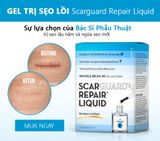  Gel Trị Sẹo Lồi Scarguard Repair Liquid 15ml (Scarguard MD) 