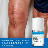  Gel Trị Sẹo Lồi Scarguard Repair Liquid 15ml (Scarguard MD) 