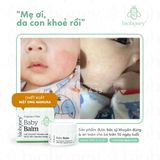  Kem Biohoney Baby Balm - Hết chàm sữa, viêm da, hăm tã, mẩn ngứa,... 