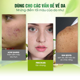  Kem Trị Nám, Loạn Sắc Tố Da Madeleine Ritchie Dark Spot Remover 