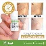  Serum đặc trị nám, đốm thâm Scarguard Lightening Serum 15ml 