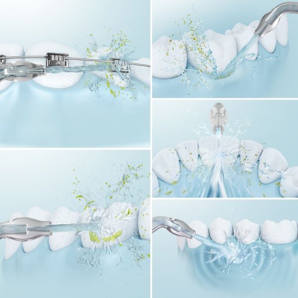 Máy tăm nước Panasonic EW1513W451