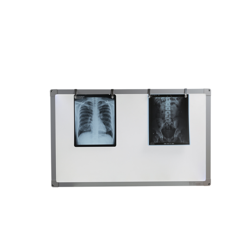  Đèn đọc phim X-Quang TNE 