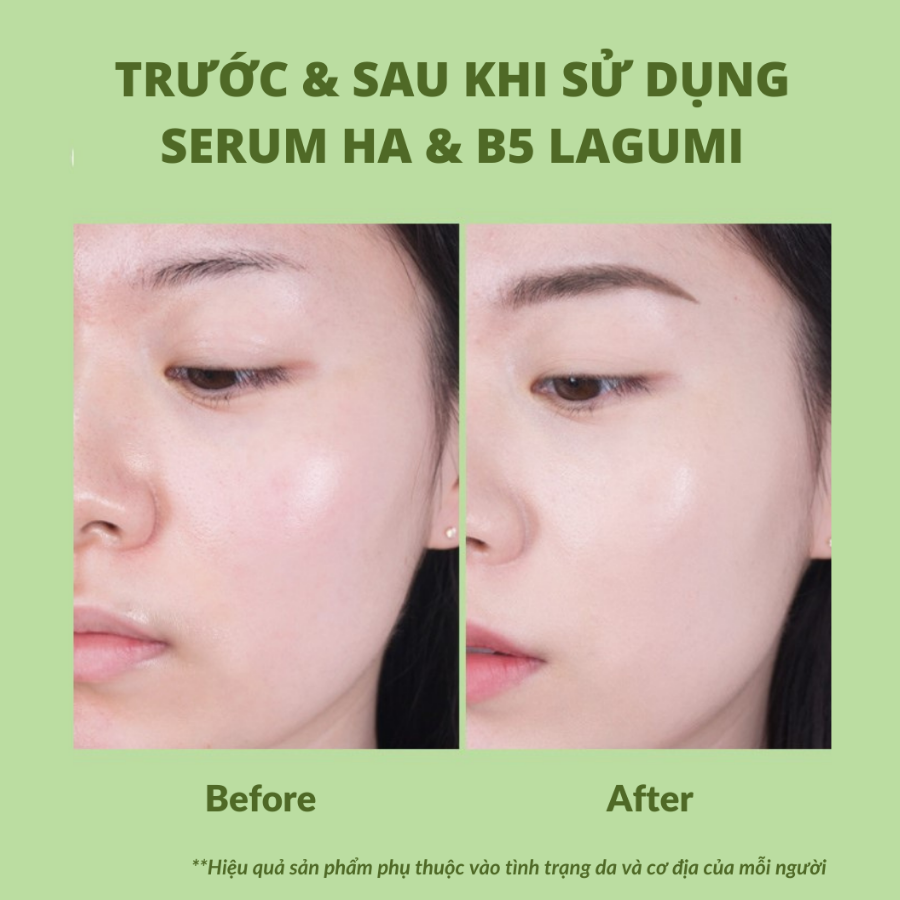 Serum siêu cấp ẩm và phục hồi da Lagumi Super HA & B5 30ml