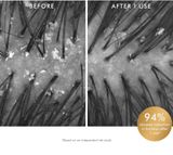  Tẩy da chết da đầu - Scalp Puifying Scrub 