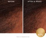  Nước hoa hồng cân bằng da đầu - Revitalizing Scalp Tonic 