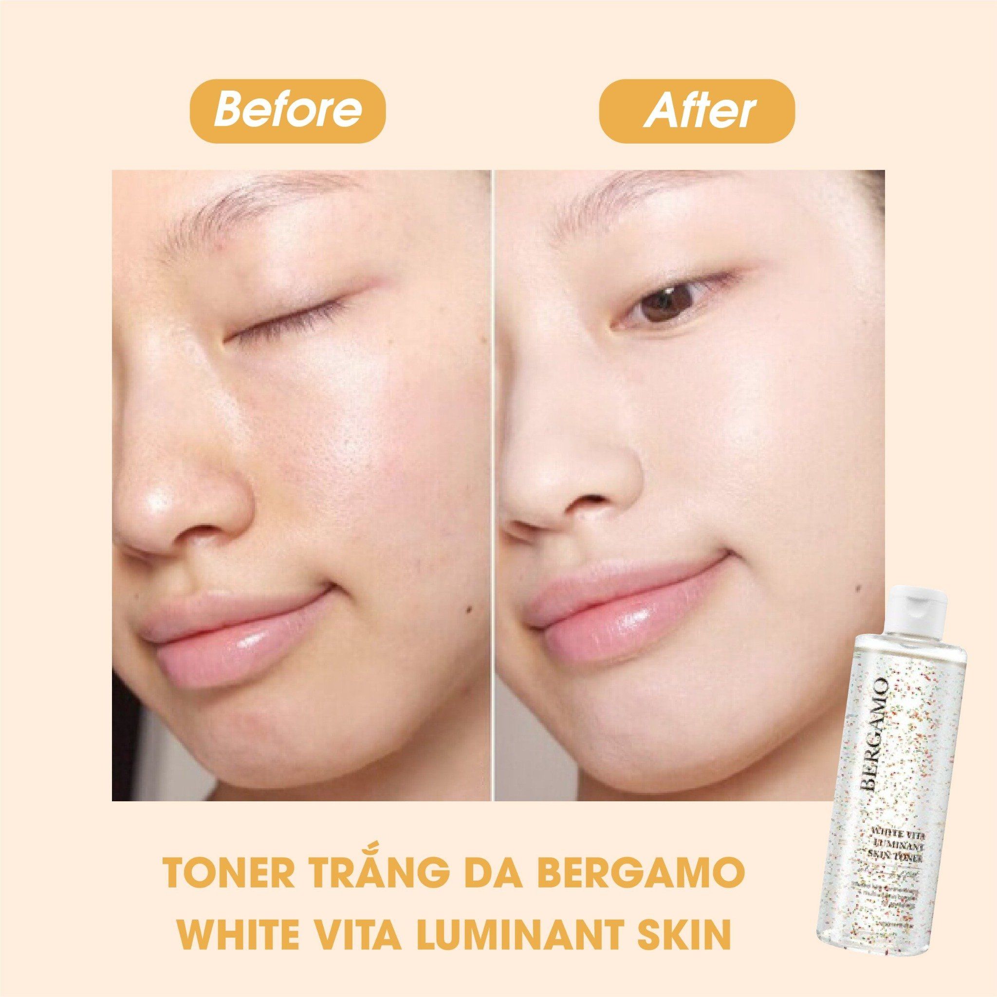TONER SÁNG DA BERGAMO WHITE VITA LUMINANT SKIN 250ML