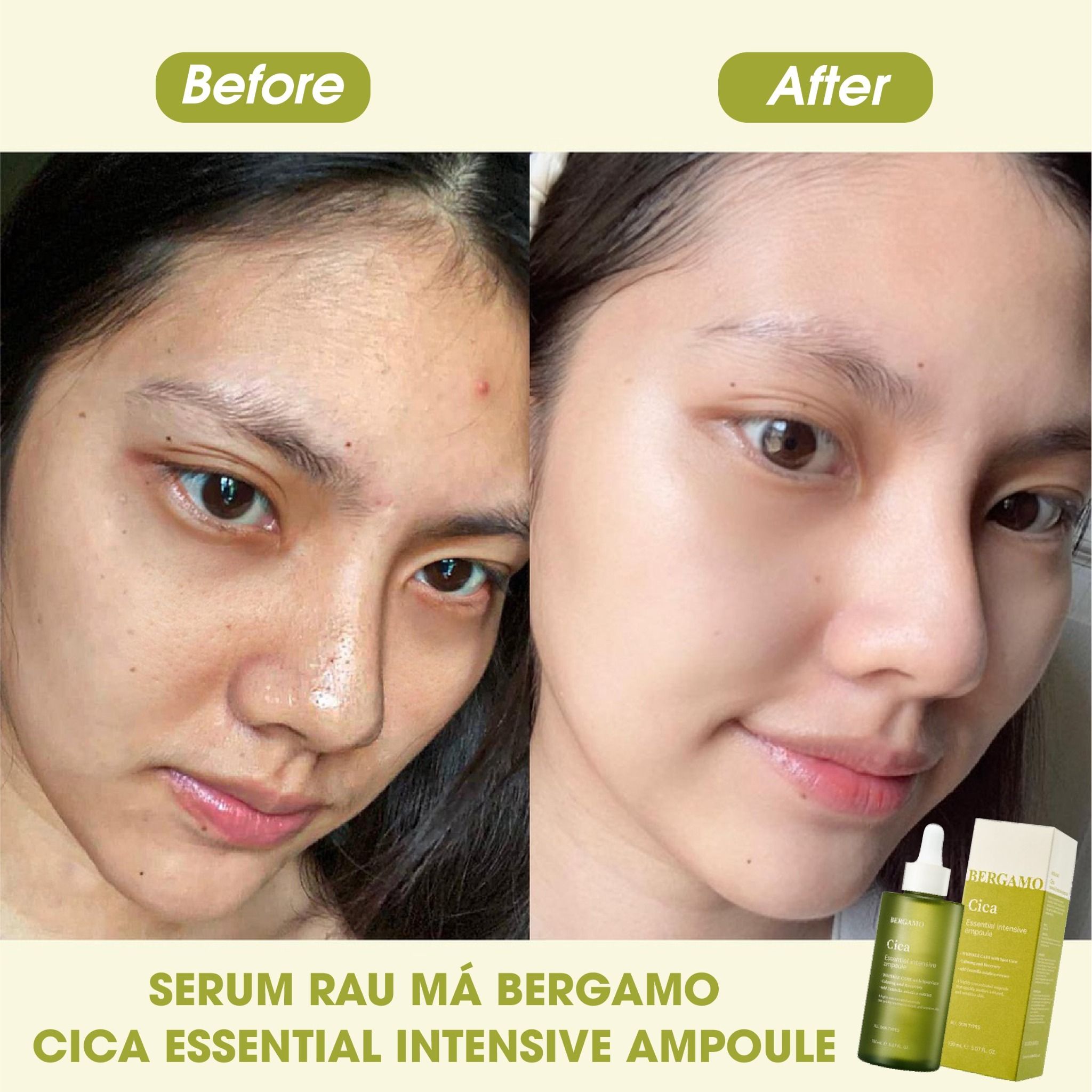 SERUM RAU MÁ BERGAMO CICA ESSENTIAL INTENSIVE AMPOULE 150ML