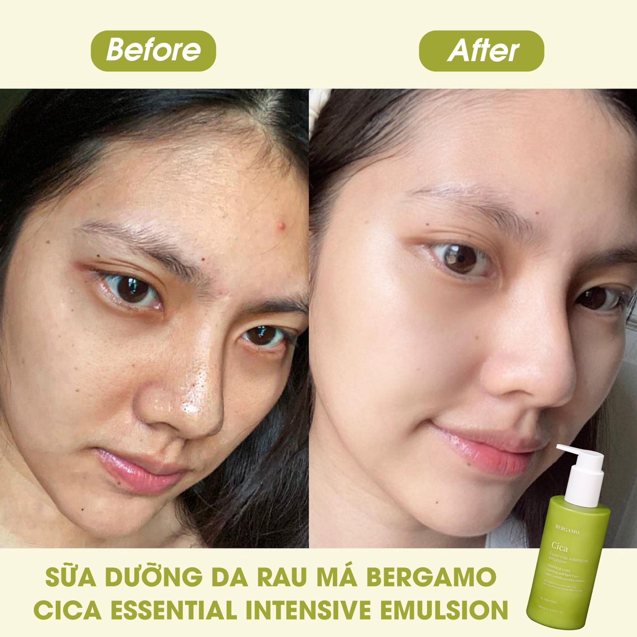 SỮA DƯỠNG DA RAU MÁ BERGAMO CICA ESSENTIAL INTENSIVE EMULSION