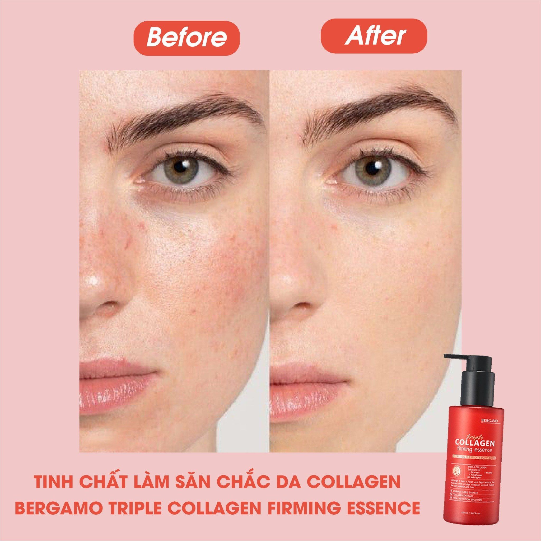 TINH CHẤT LÀM SĂN CHẮC DA BERGAMO TRIPLE COLLAGEN FIRMING ESSENCE 150ML
