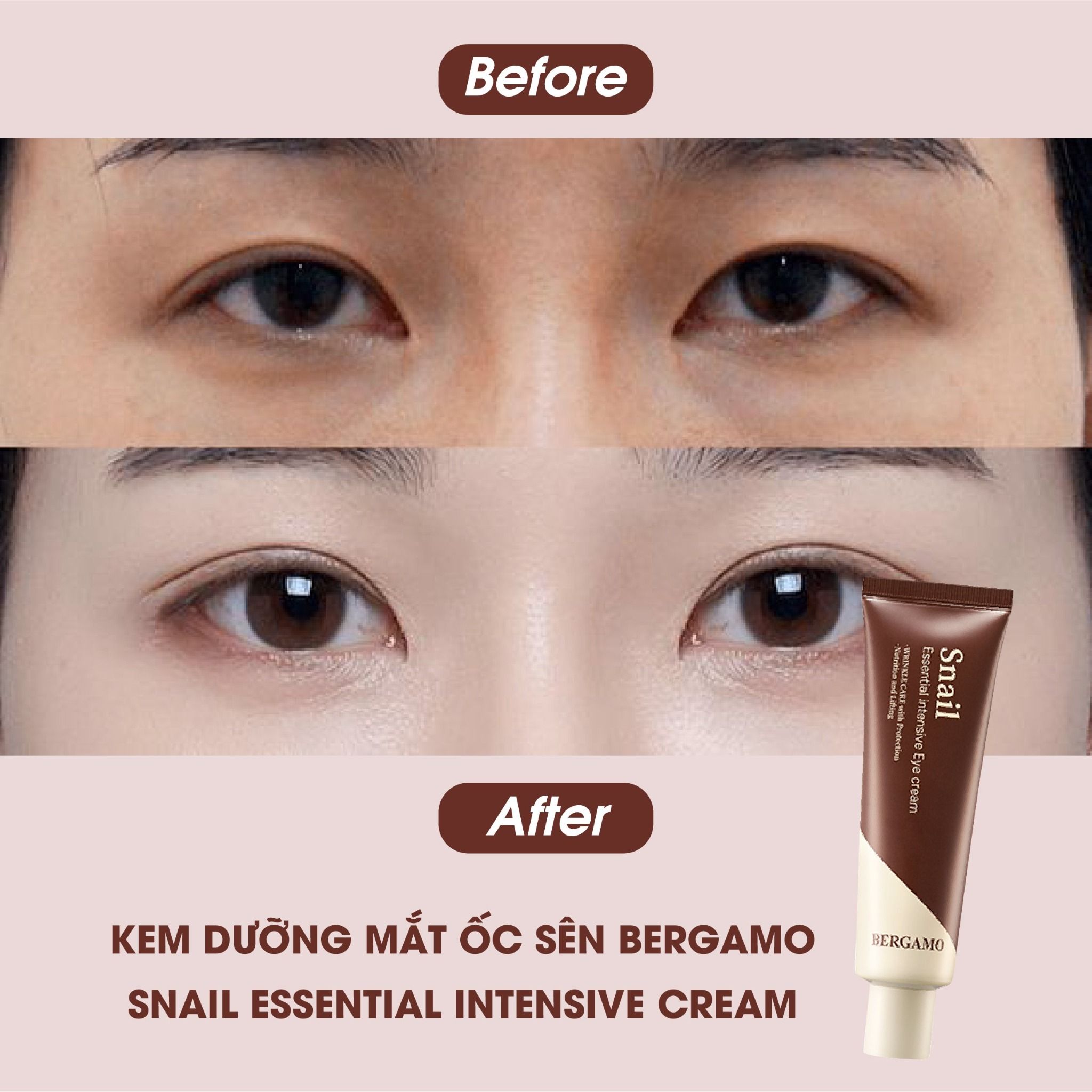 KEM DƯỠNG MẮT ỐC SÊN BERGAMO SNAIL ESSENTIAL INTENSIVE EYE CREAM 100G
