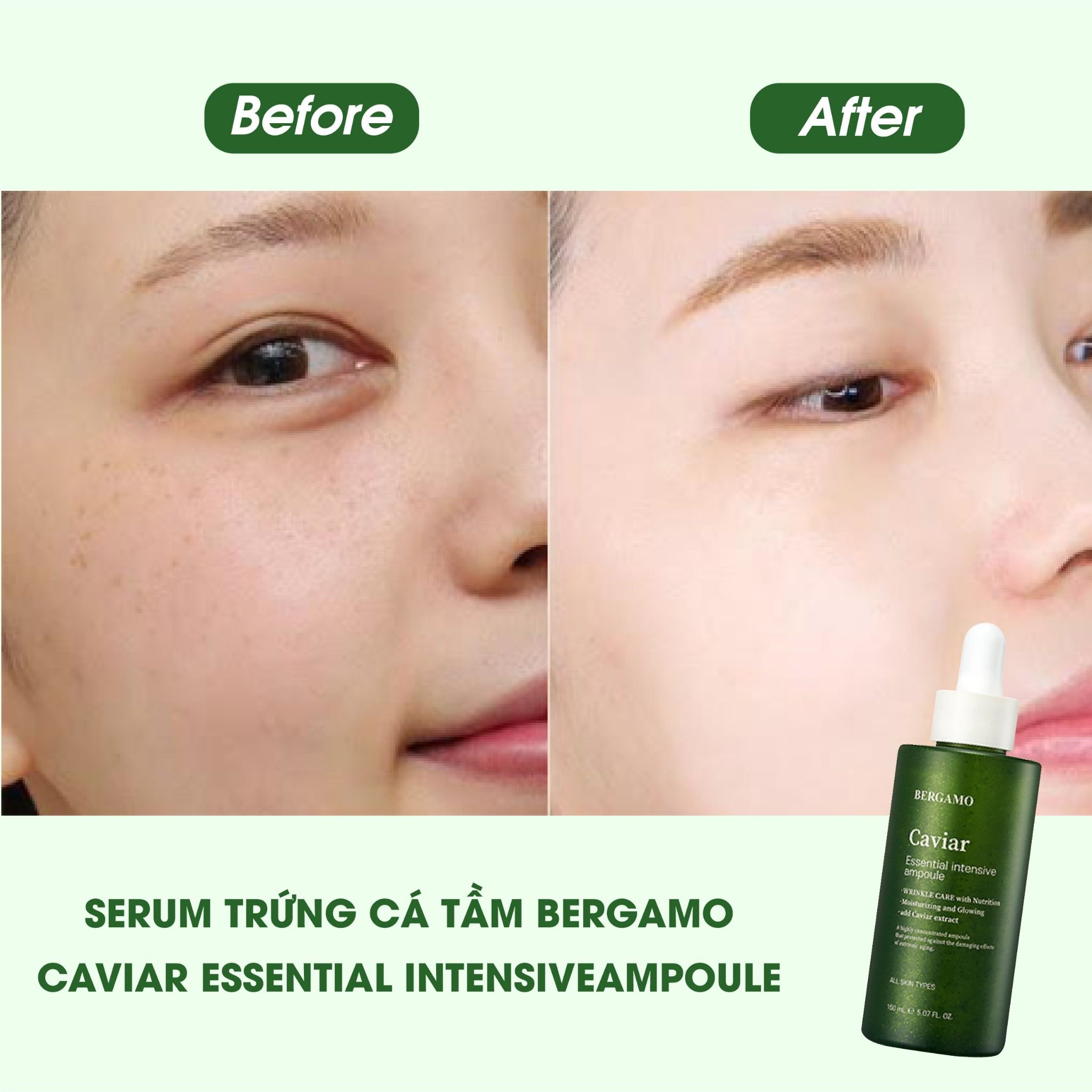 TINH CHẤT TRỨNG CÁ TẦM BERGAMO CAVIAR ESSENTIAL INTENSIVE AMPOULE