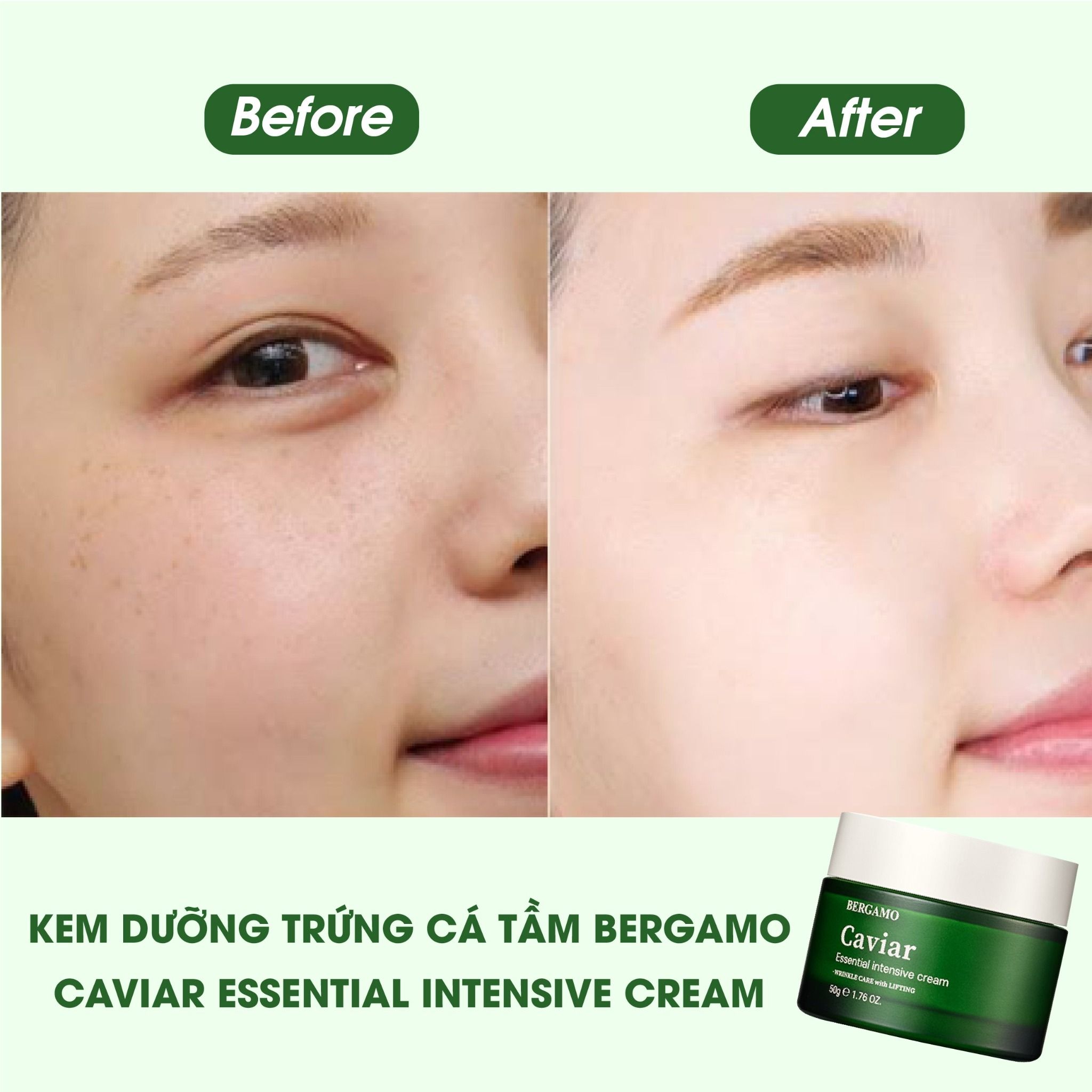 KEM DƯỠNG TRỨNG CÁ TẦM BERGAMO CAVIAR ESSENTIAL INTENSIVE CREAM 50G