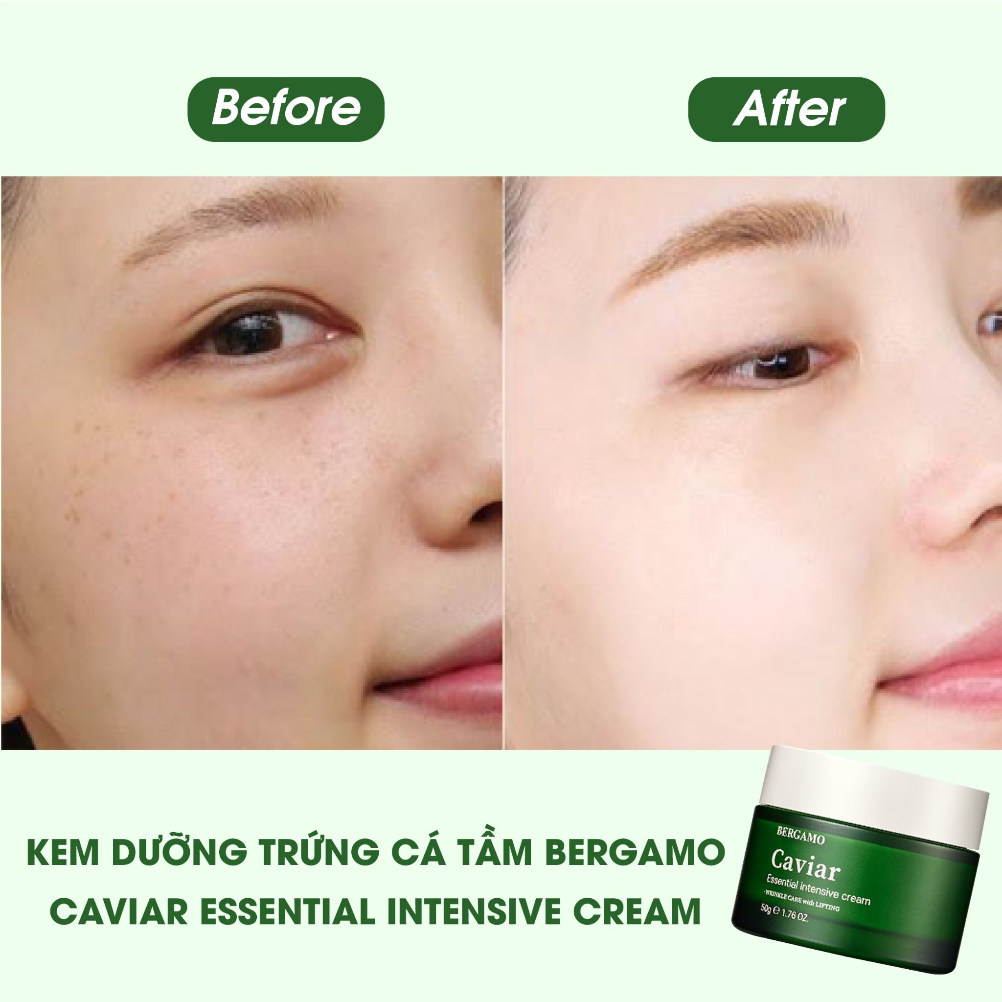 KEM DƯỠNG TRỨNG CÁ TẦM BERGAMO CAVIAR ESSENTIAL INTENSIVE CREAM 50G