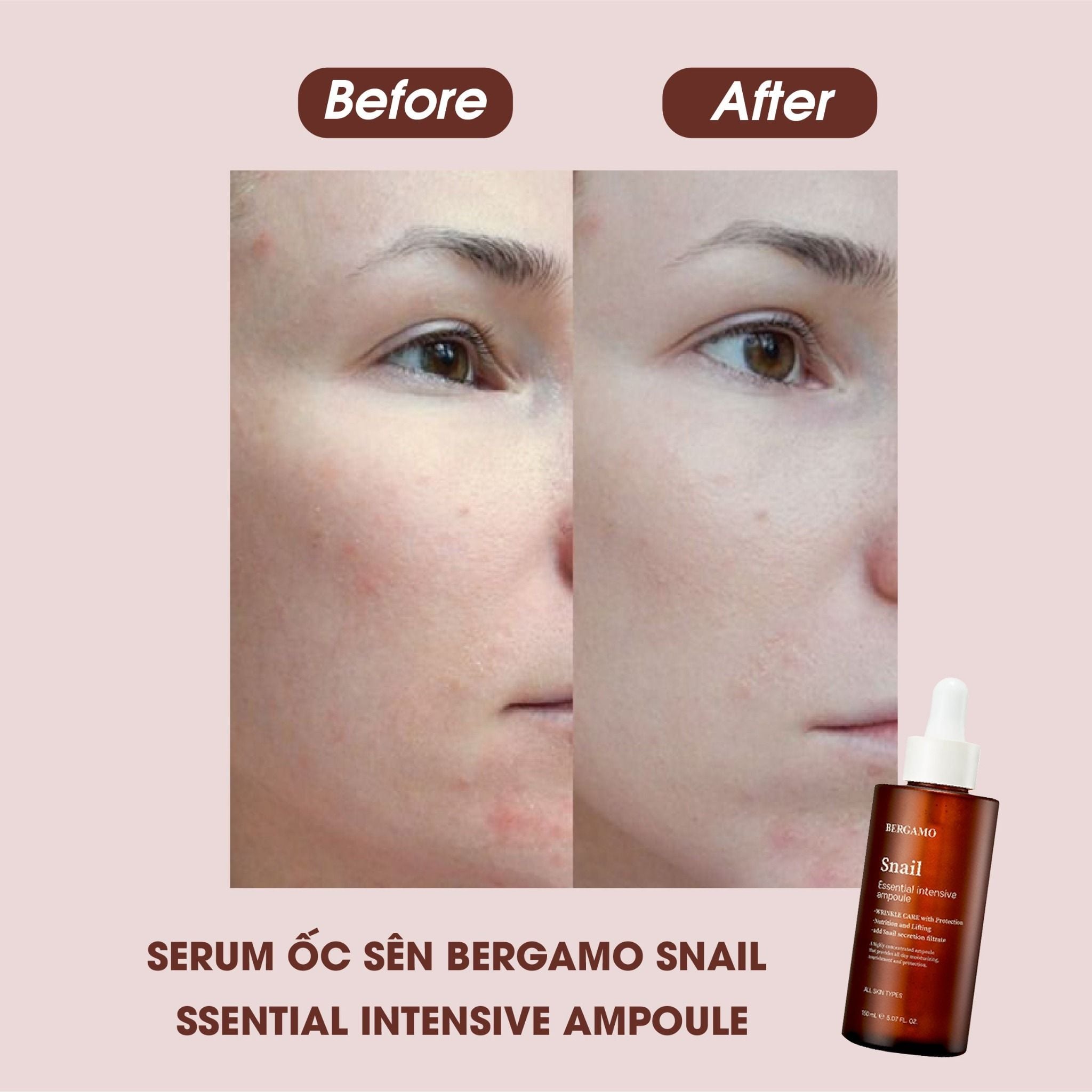 TINH CHẤT ỐC SÊN BERGAMO SNAIL ESSENTIAL INTENSIVE AMPOULE 150ML