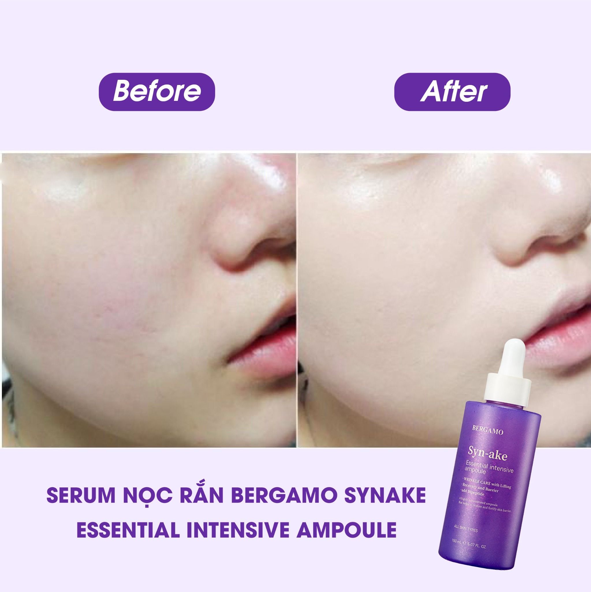 TINH CHẤT NỌC RẮN BERGAMO SYNAKE ESSENTIAL INTENSIVE AMPOULE 150ML