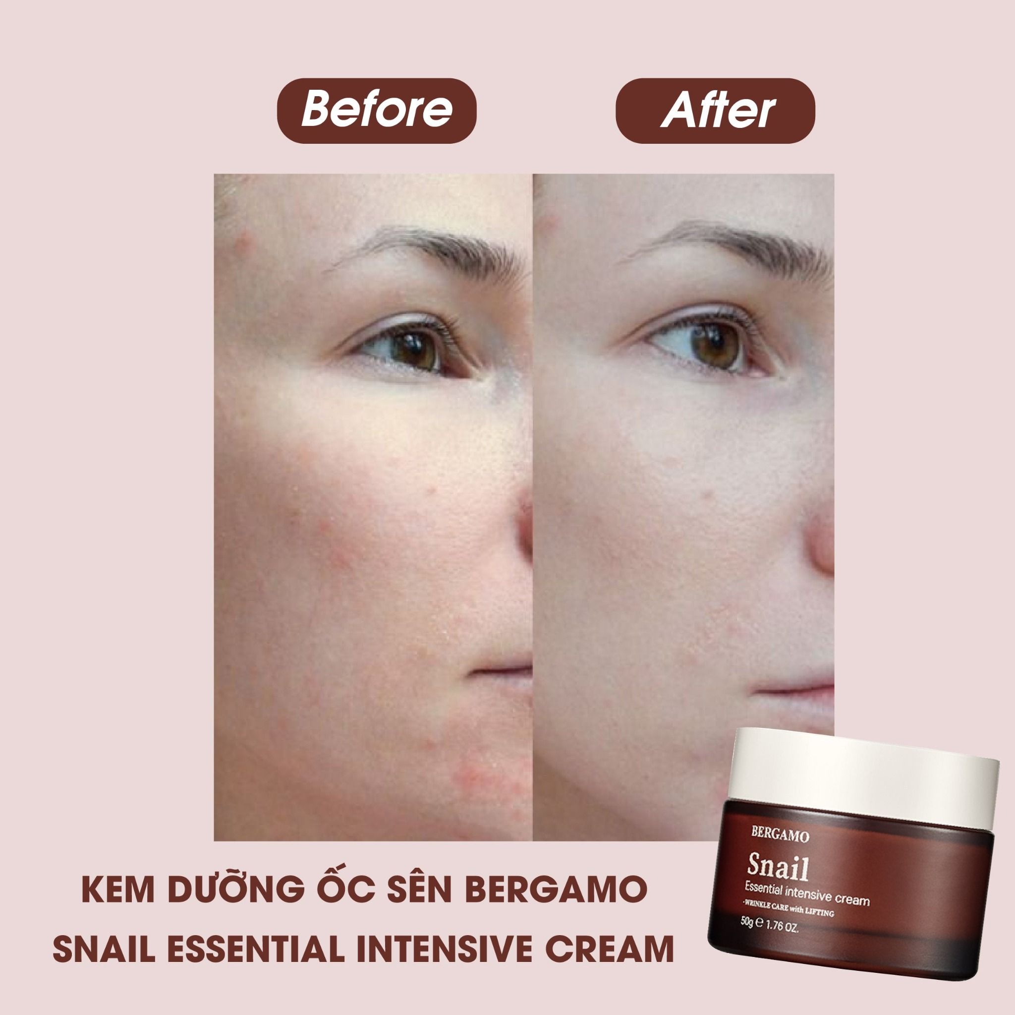 KEM DƯỠNG ỐC SÊN BERGAMO SNAIL ESSENTIAL INTENSIVE CREAM 50G