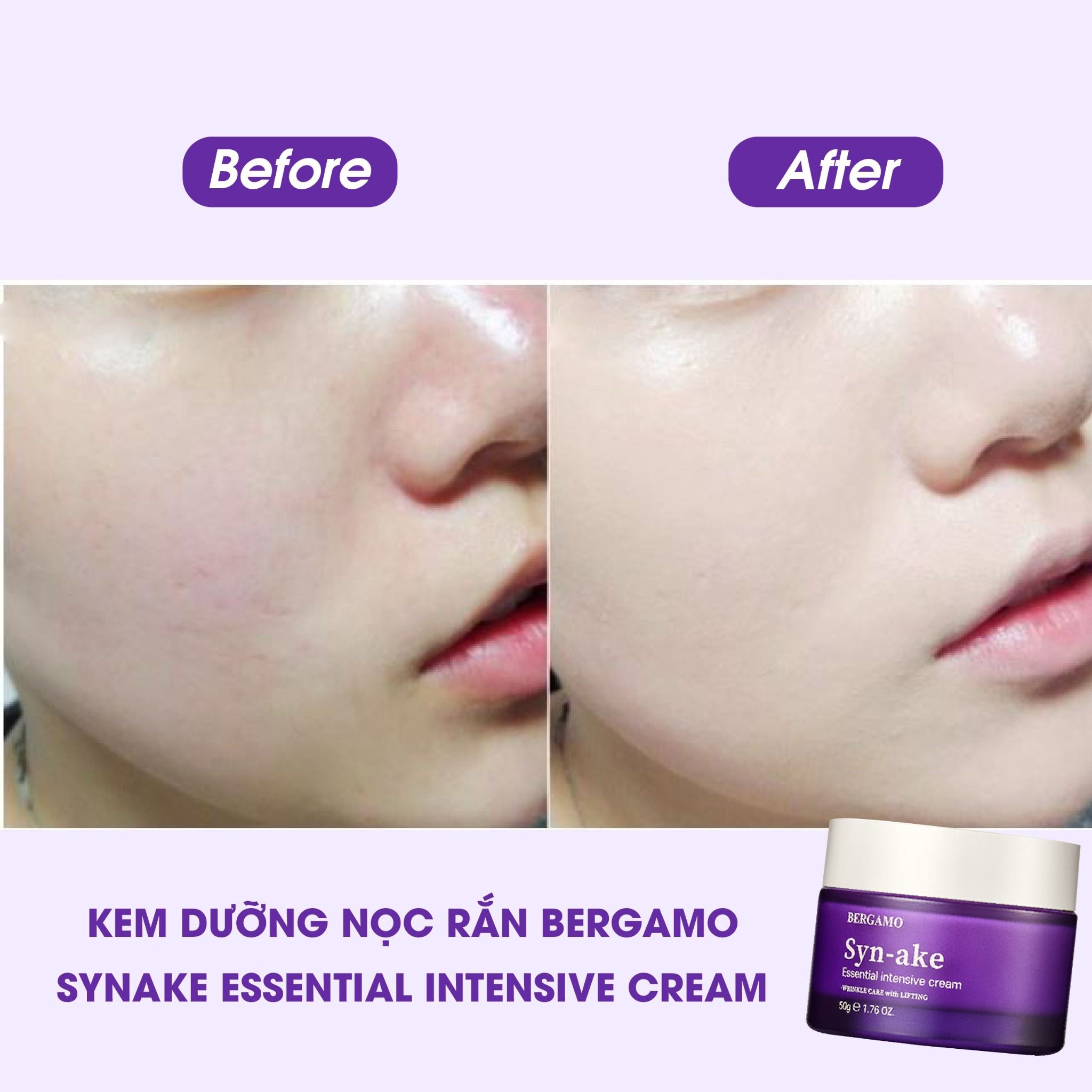 KEM DƯỠNG NỌC RẮN BERGAMO SYNAKE ESSENTIAL INTENSIVE CREAM 50G