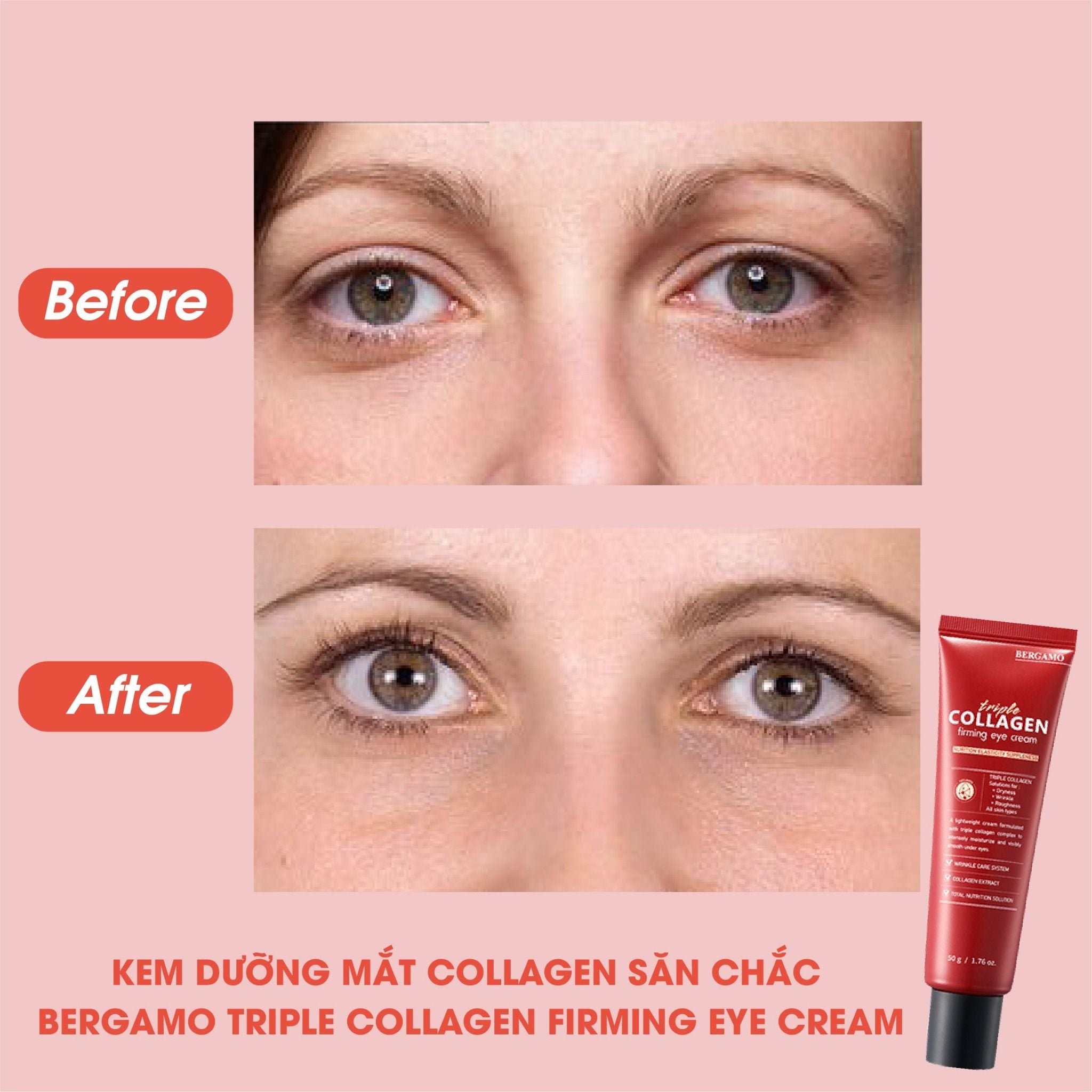 KEM DƯỠNG MẮT COLLAGEN SĂN CHẮC BERGAMO TRIPLE COLLAGEN FIRMING EYE CREAM 50G