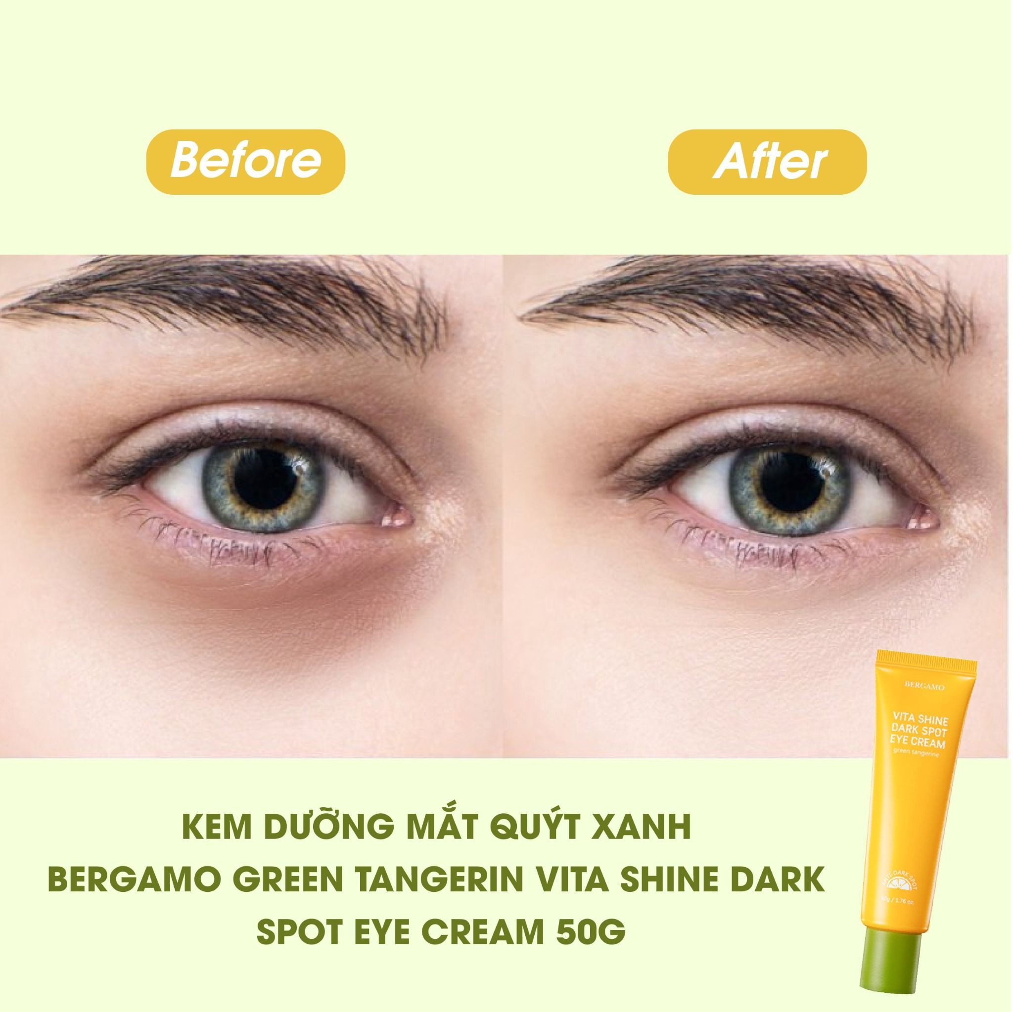 KEM DƯỠNG MẮT QUÝT XANH BERGAMO GREEN TANGERINE VITA SHINE DARK SPOT EYE CREAM 50G (TẶNG TUÝP 10ML)