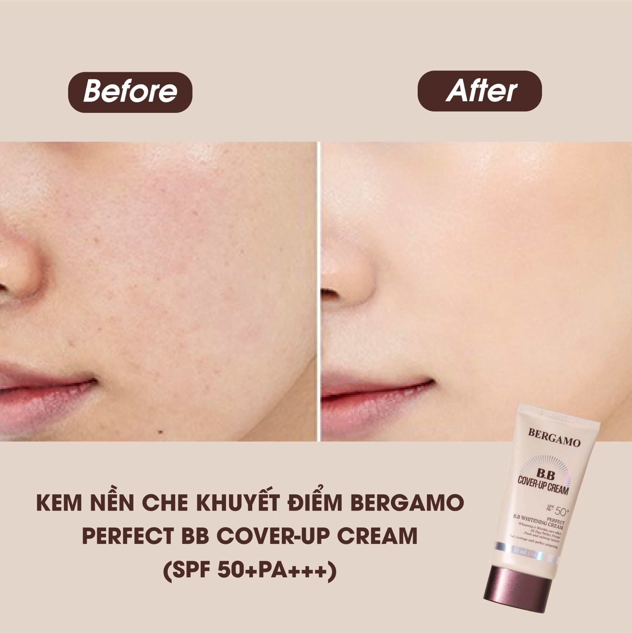 KEM NỀN CHE KHUYẾT ĐIỂM BERGAMO PERFECT BB COVER-UP CREAM SPF 50+PA+++ 50ML