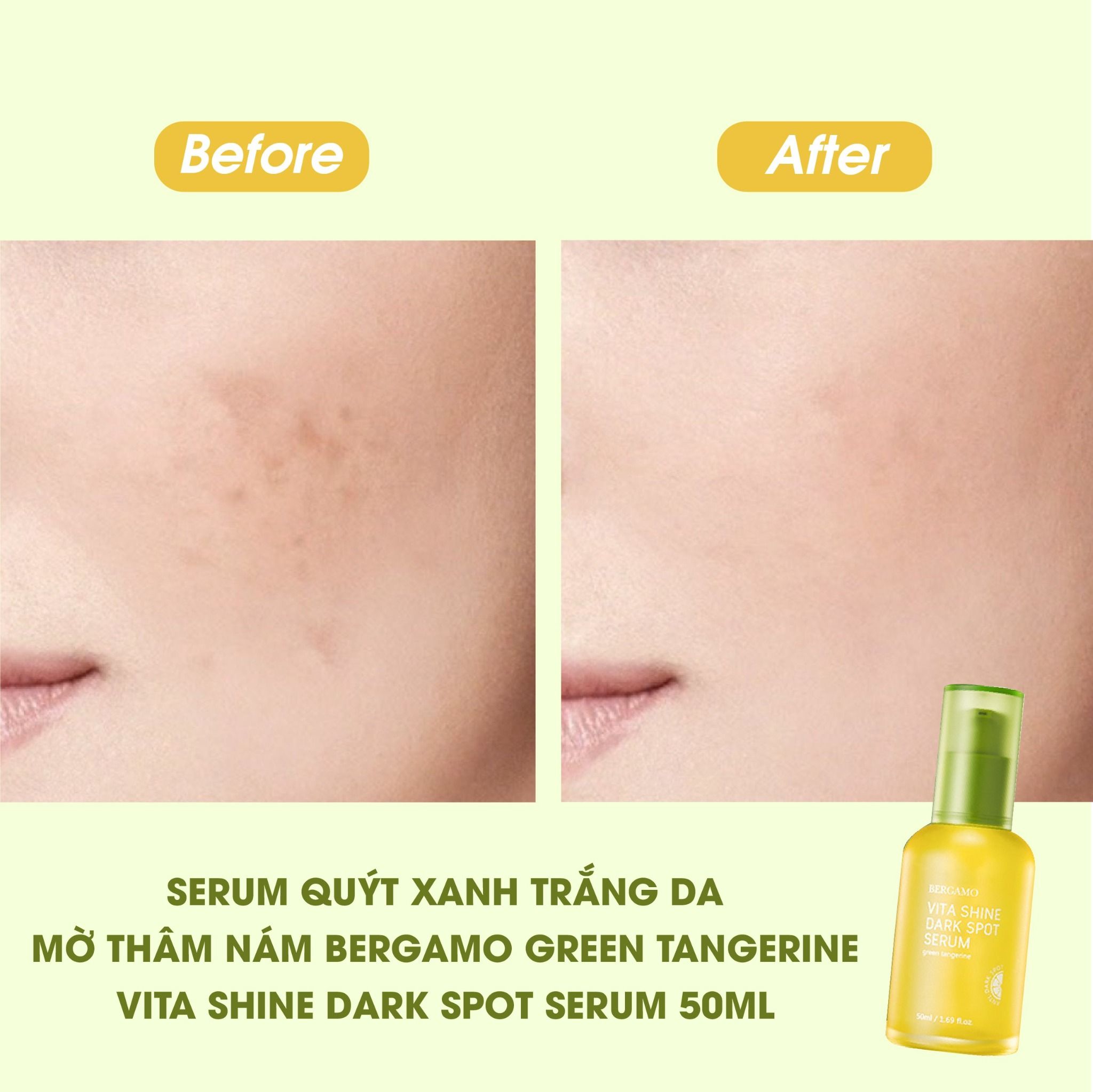 SERUM QUÝT XANH SÁNG DA MỜ THÂM NÁM BERGAMO GREEN TANGERINE VITA SHINE DARK SPOT SERUM 50ML