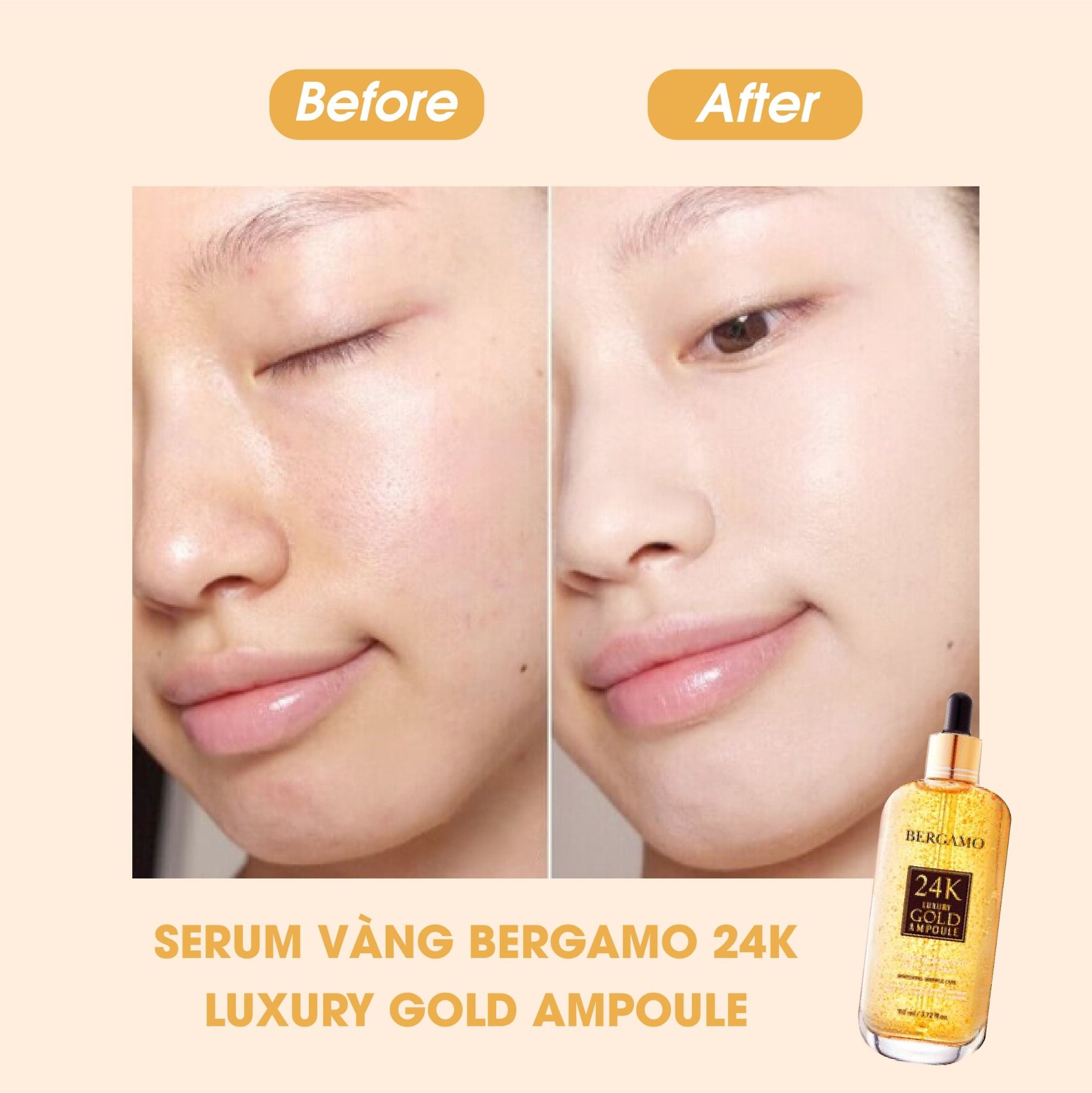 TINH CHẤT VÀNG BERGAMO 24K LUXURY GOLD AMPOULE 110ML