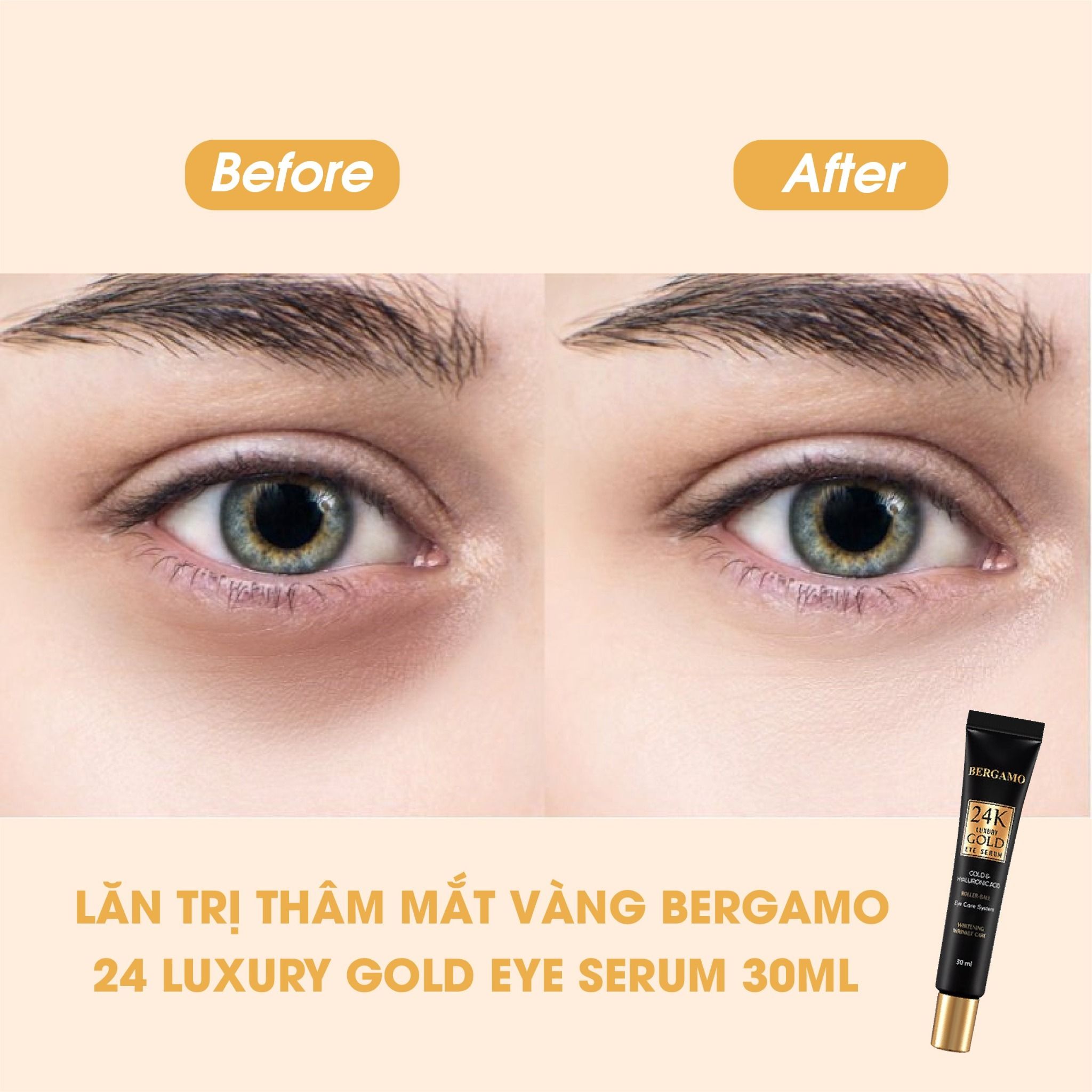 LĂN GIẢM THÂM MẮT VÀNG BERGAMO 24K LUXURY GOLD EYE SERUM 30ML