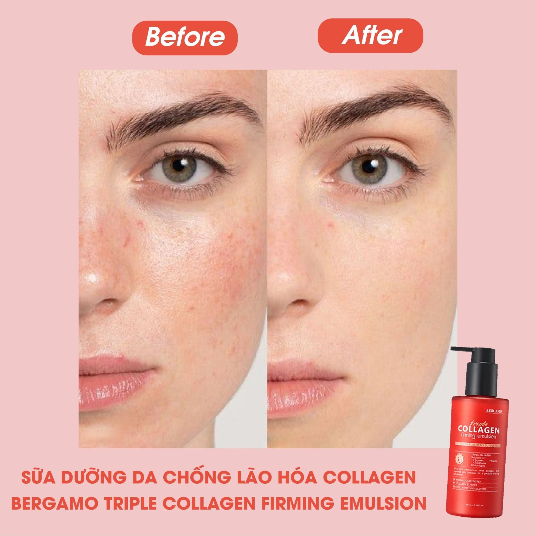 SỮA DƯỠNG DA CHỐNG LÃO HÓA BERGAMO TRIPLE COLLAGEN FIRMING EMULSION
