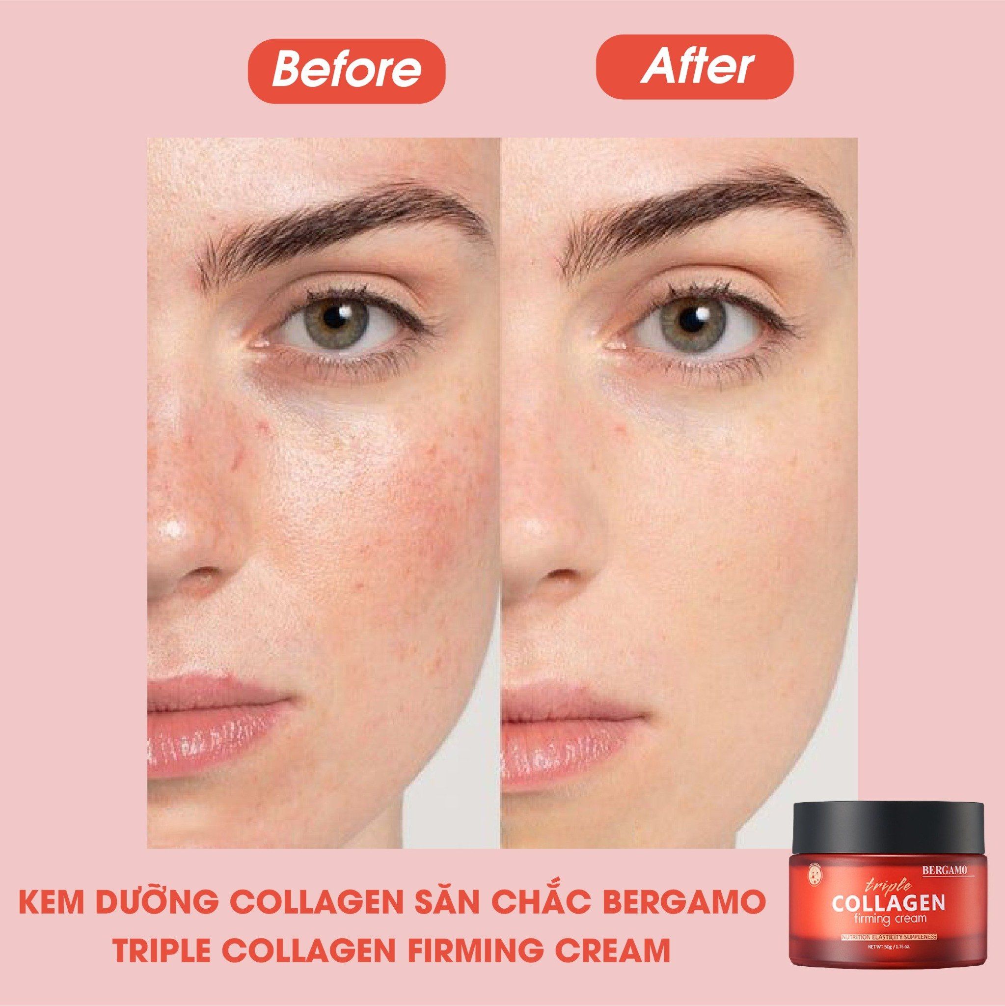 KEM DƯỠNG COLLAGEN SĂN CHẮC BERGAMO TRIPLE COLLAGEN FIRMING CREAM 50G