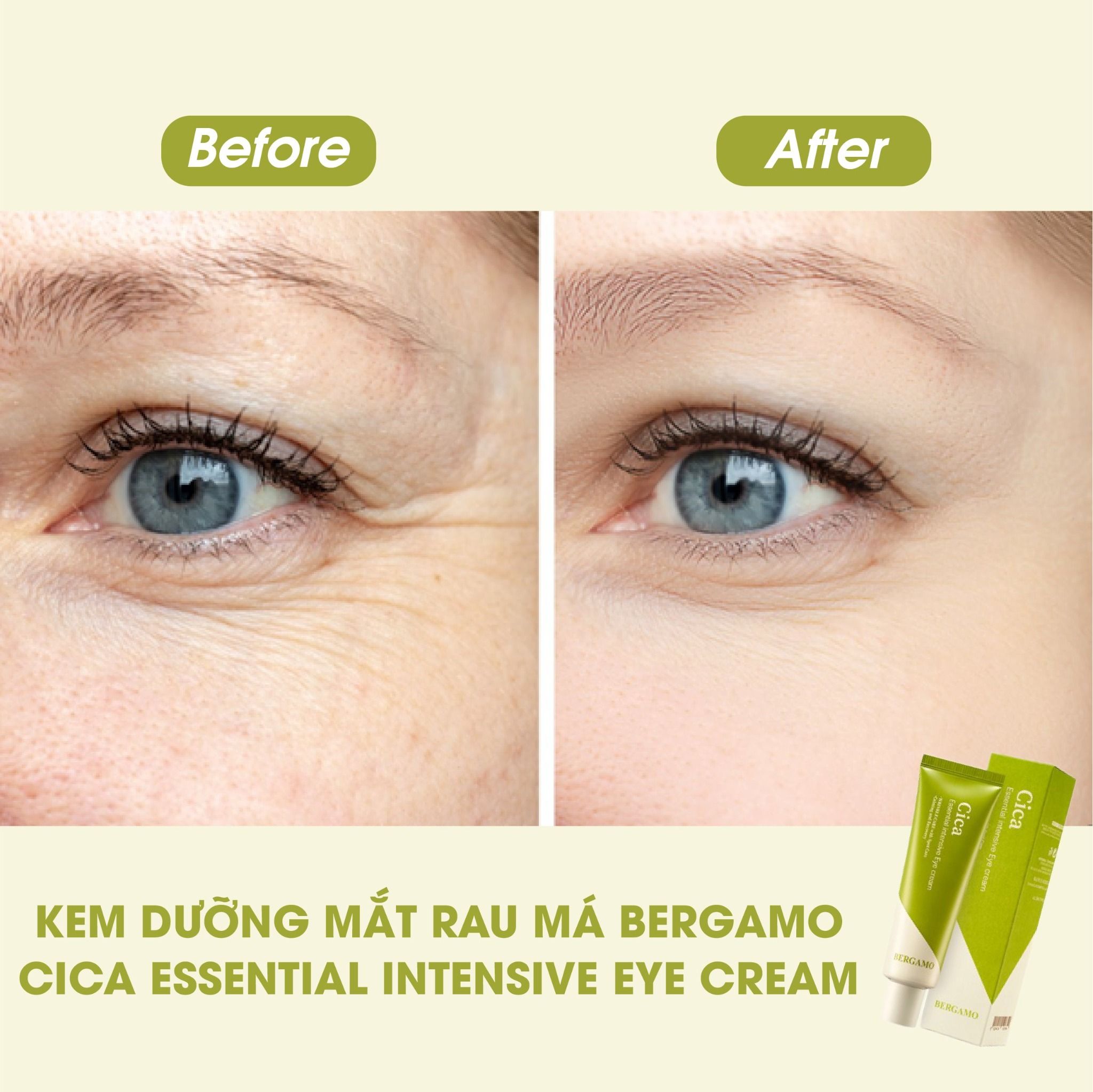 KEM DƯỠNG MẮT RAU MÁ BERGAMO CICA ESSENTIAL INTENSIVE EYE CREAM 100G
