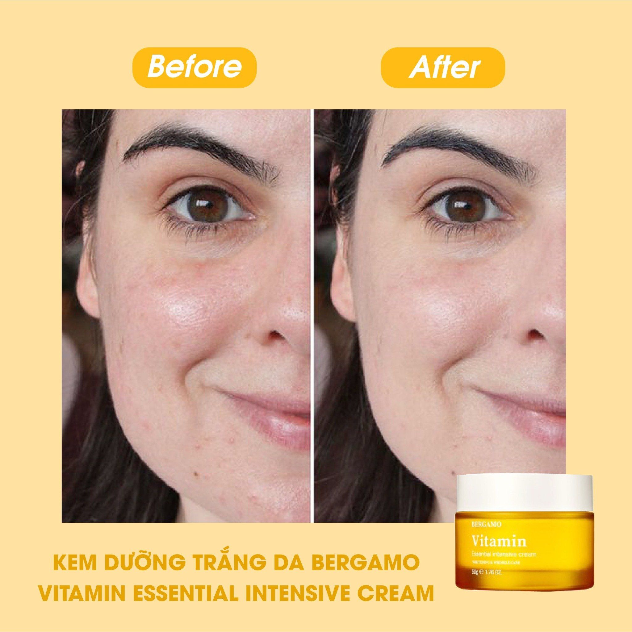 KEM DƯỠNG SÁNG DA BERGAMO VITAMIN ESSENTIAL INTENSIVE CREAM 50G