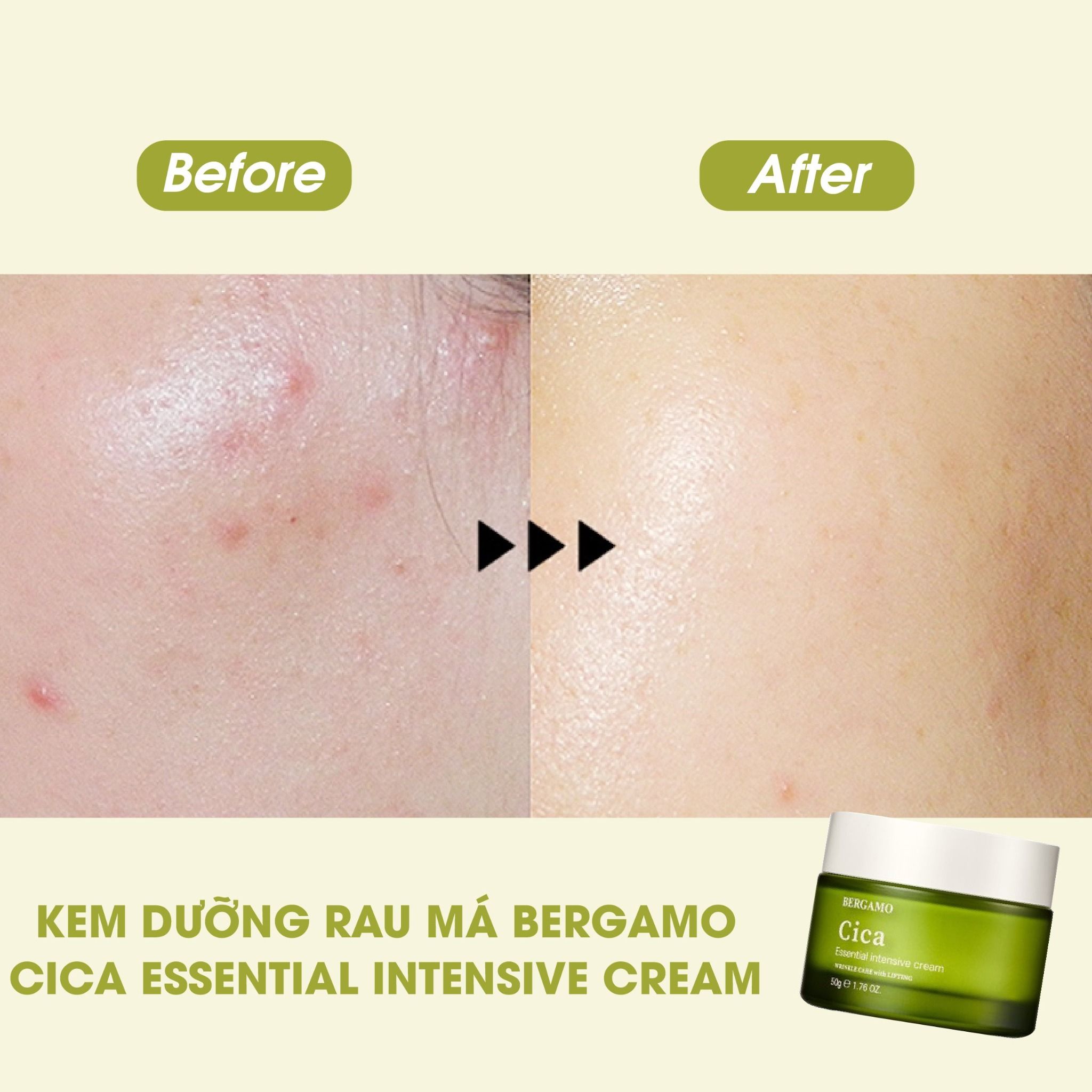 KEM DƯỠNG RAU MÁ BERGAMO CICA ESSENTIAL INTENSIVE CREAM 50G