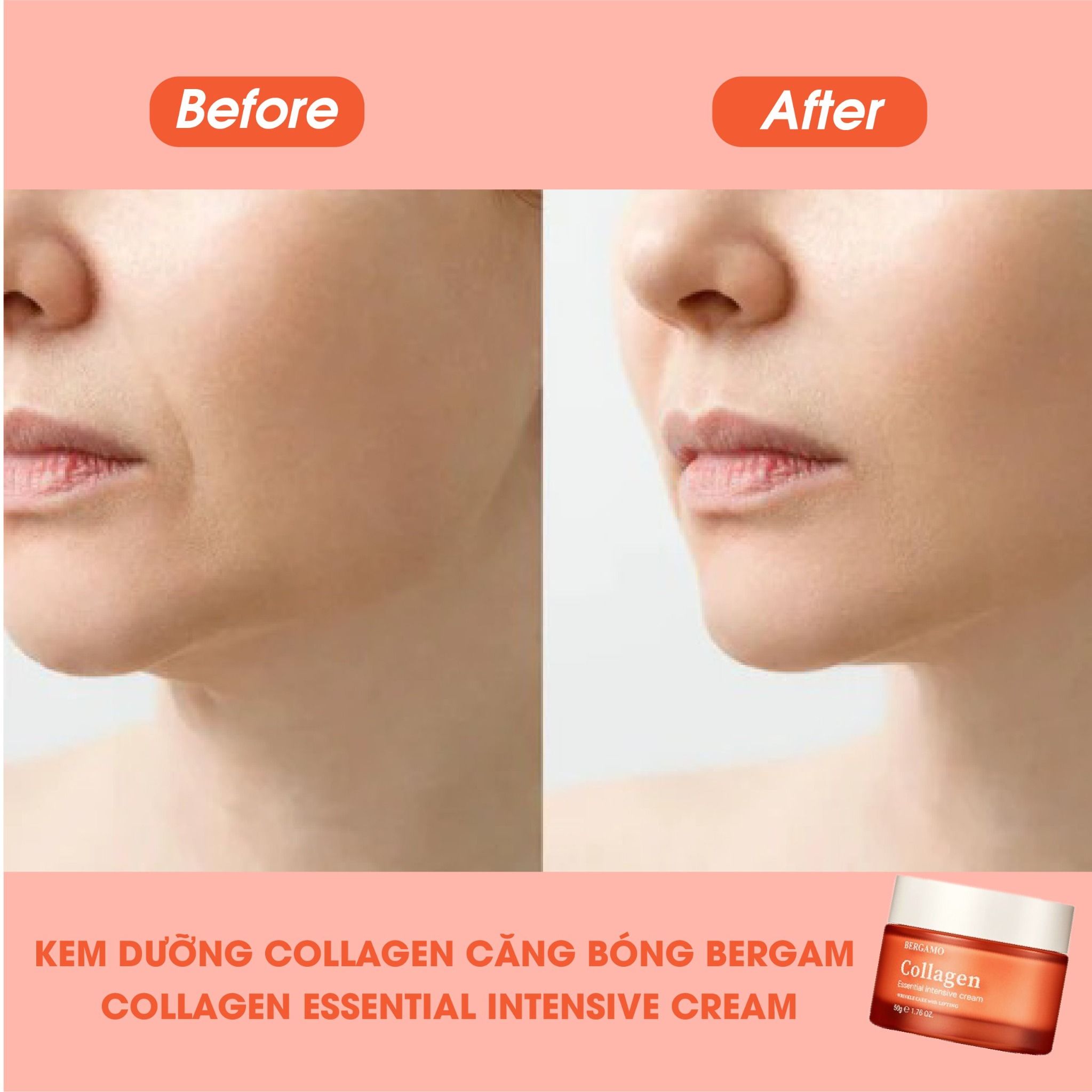 KEM DƯỠNG CĂNG BÓNG COLLAGEN BERGAMO COLLAGEN ESSENTIAL INTENSIVE CREAM 50G