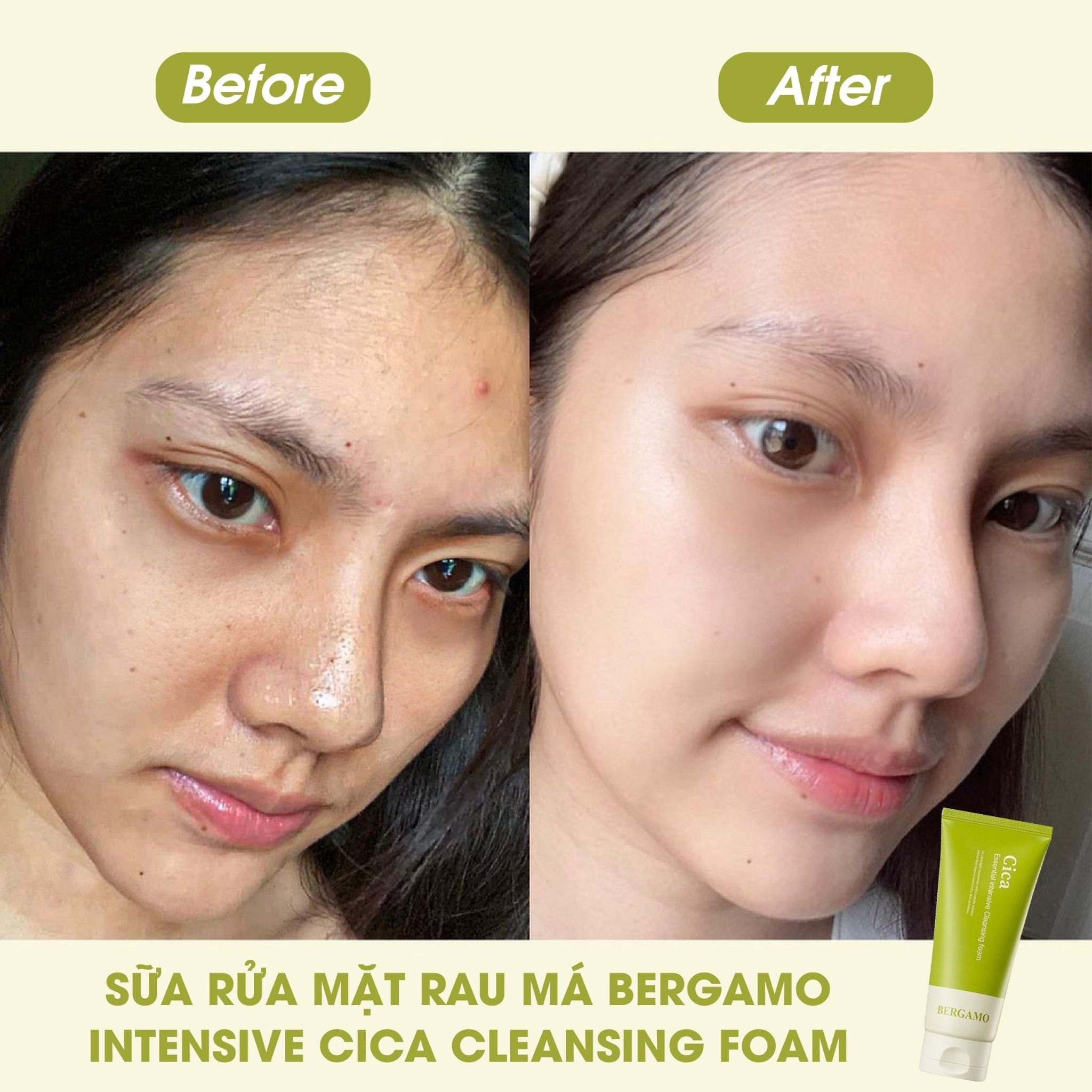 SỮA RỬA MẶT RAU MÁ BERGAMO CICA ESSENTIAL INTENSIVE CLEANSING FOAM 120ML